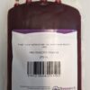 Fresh human red blood cells from whole human blood in CPD - male donor - chilled overnight delivery - RBC1DC4CPD200-M