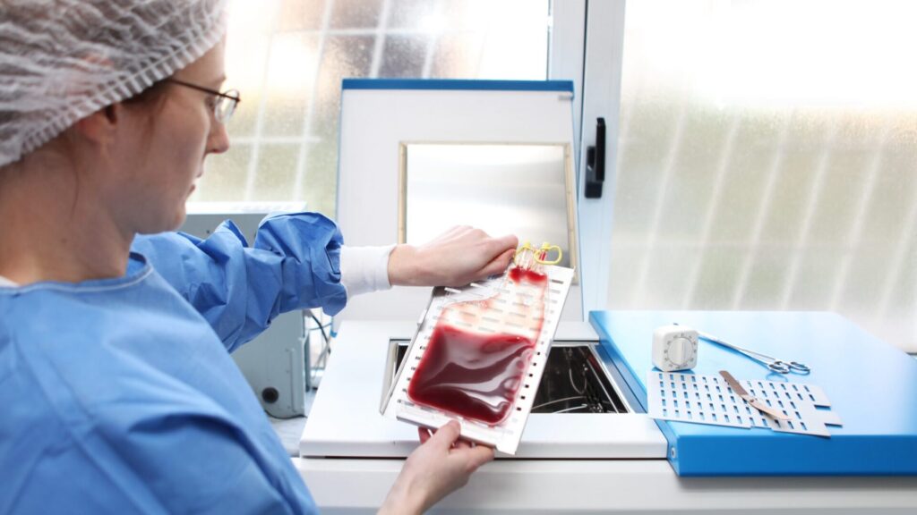 Fresh vs. Frozen PBMCs: the best option for your research