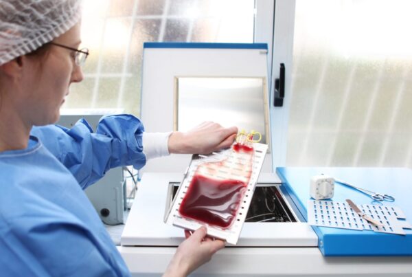 Fresh vs. Frozen PBMCs: the best option for your research