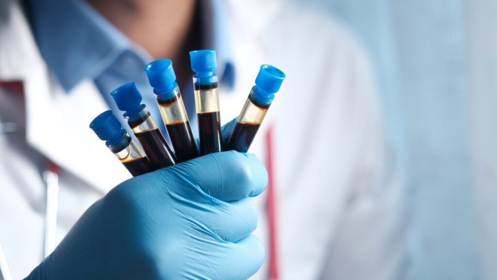blood biospecimens for research