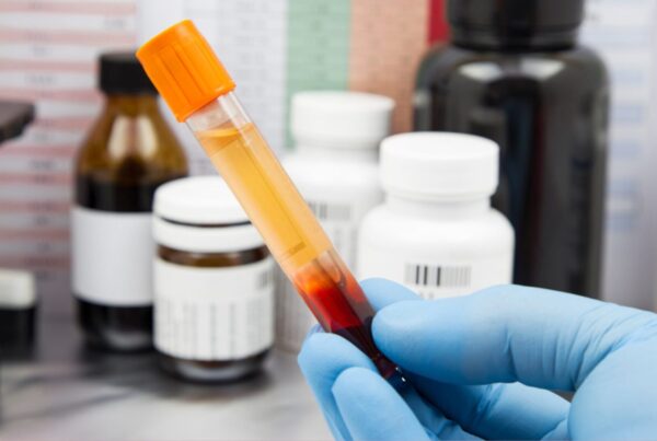 Choosing the Right Blood Biospecimens Supplier